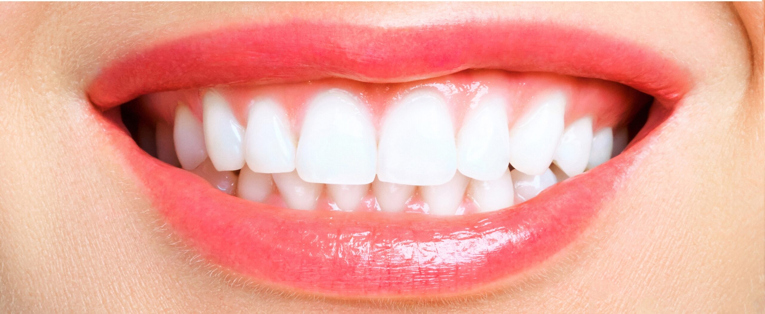 woman teeth before and after whitening. Over white background. Dental clinic patient. Image symbolizes oral care dentistry, stomatology.