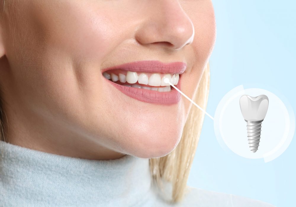 Young woman with implanted teeth on color background, closeup